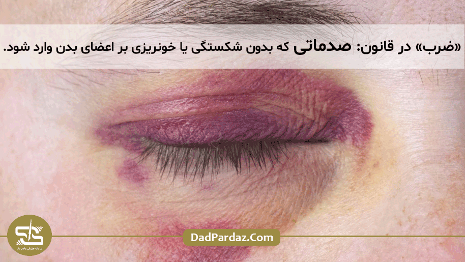 ضرب چیست؟